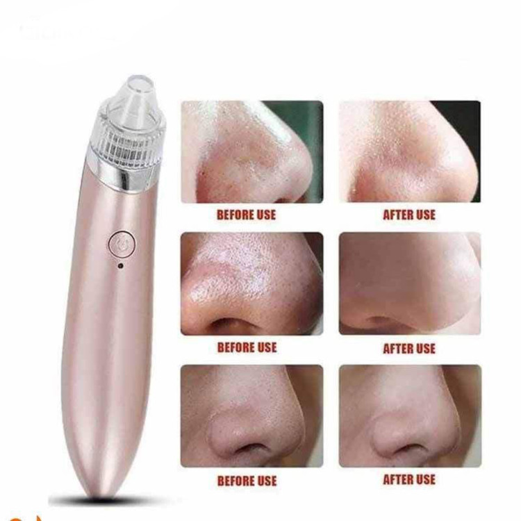 میکرودرم خانگی مدل XN-8030